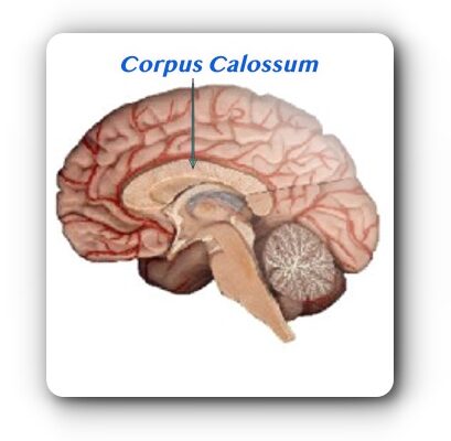 Corpus Calossum