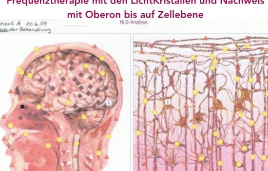 Ascension-Frequenz-herapie-Oberon-Nachweis